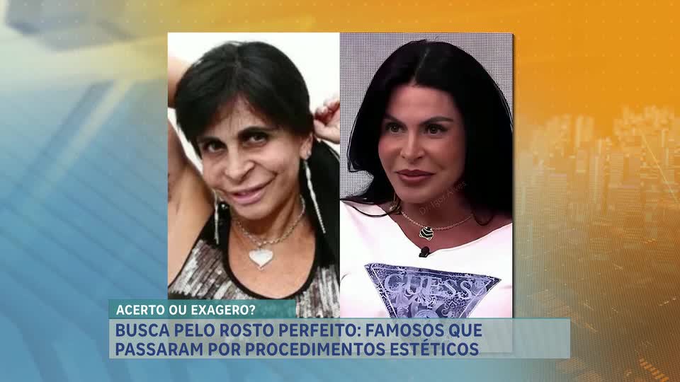 Mudanças estéticas em celebridades geram polêmica entre os fãs