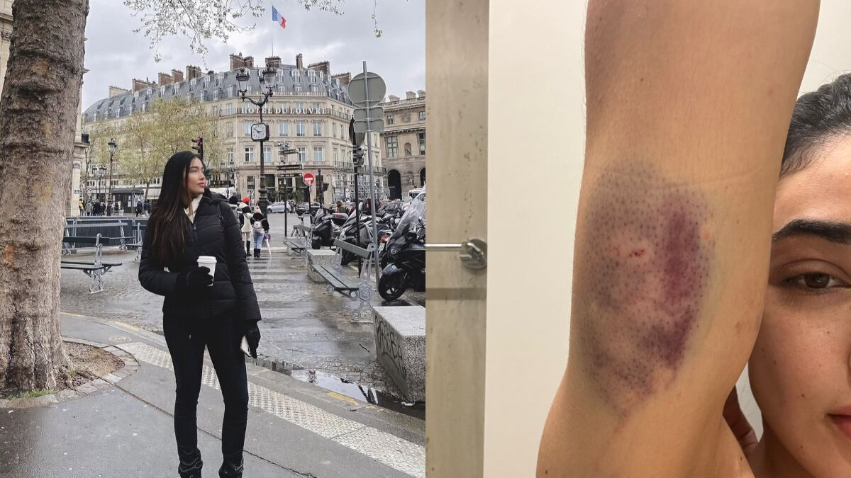 Influenciadora denuncia agressões de companheiro após festa de Ano-Novo em Belo Horizonte