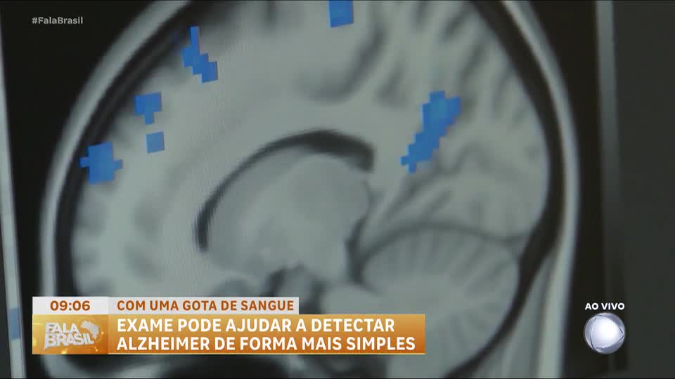 Teste de sangue promete diagnóstico precoce do Alzheimer