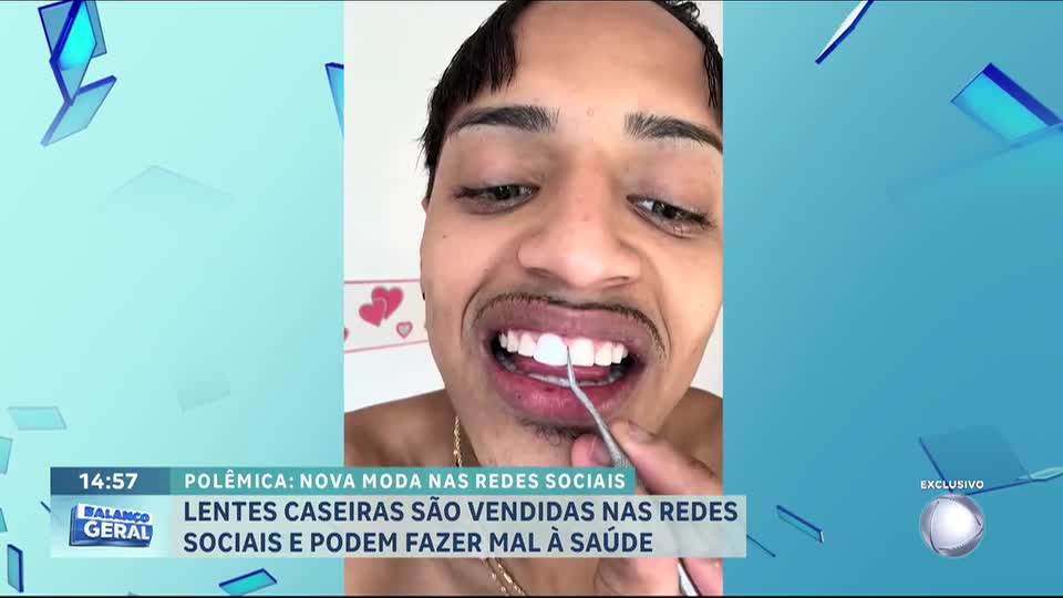 Lentes dentárias caseiras e baratas vendidas pela internet podem fazer mal à saúde