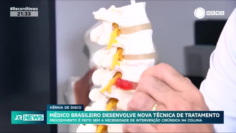 Hérnia de disco: nova técnica promete tratar sem cirurgia