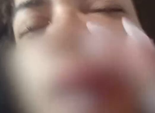 Mulher leva socos e perde três dentes ao tentar ajudar vizinha agredida pelo marido no Rio