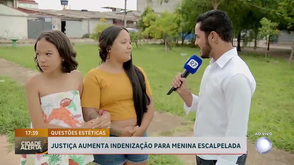 Justiça aumenta indenização para menina escalpelada em parquinho de Santa Maria (DF)