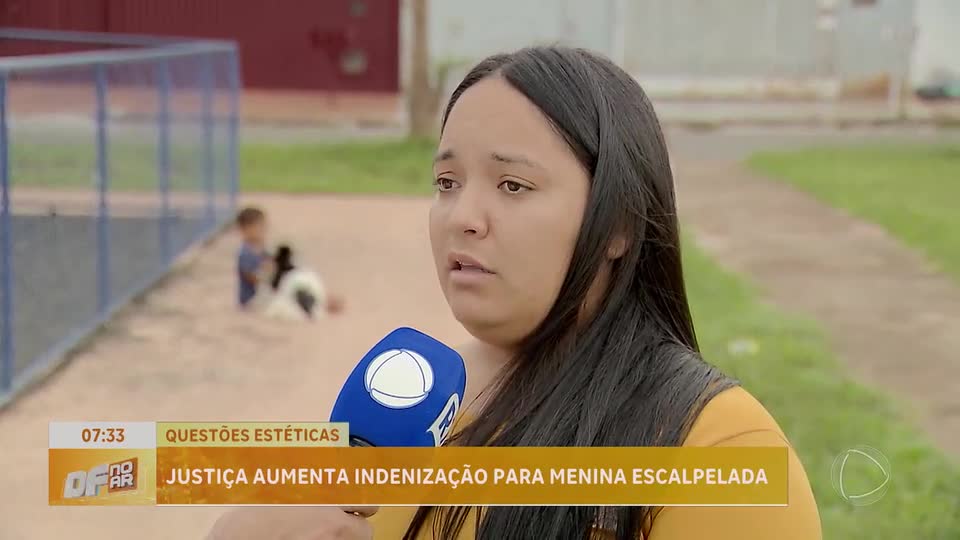 Justiça determina aumento de indenização para família de menina que perdeu couro cabeludo no DF