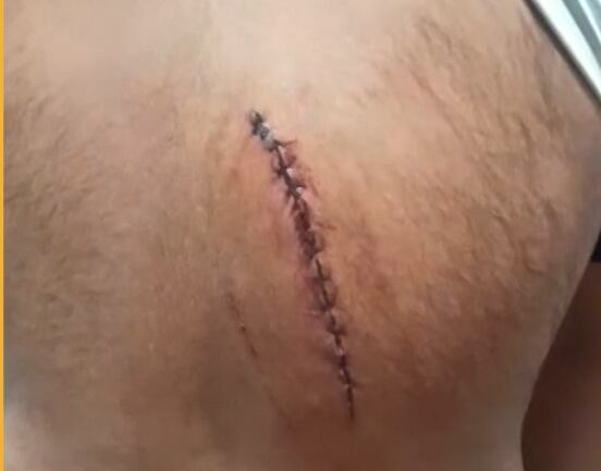 Banhista é atropelado por moto aquática na Barra da Tijuca, zona sudoeste do Rio