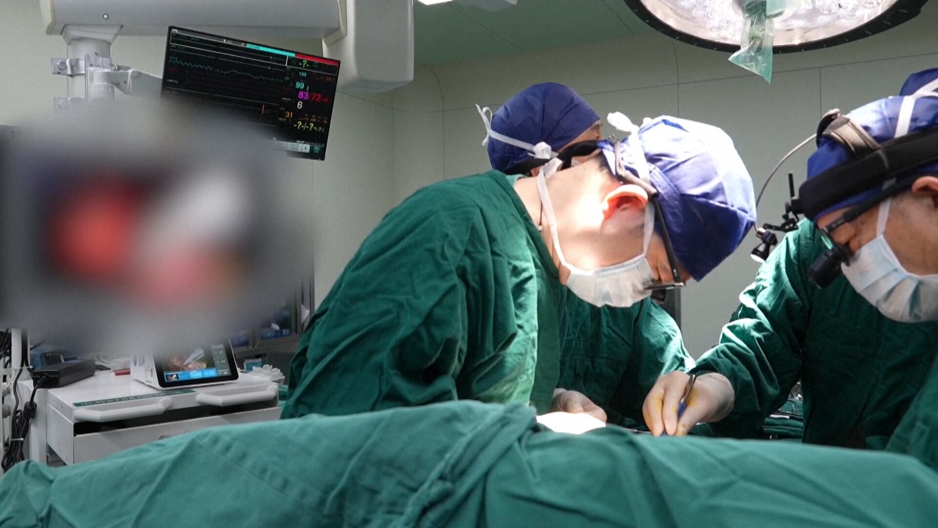 Médicos realizam transplante com pequeno corte