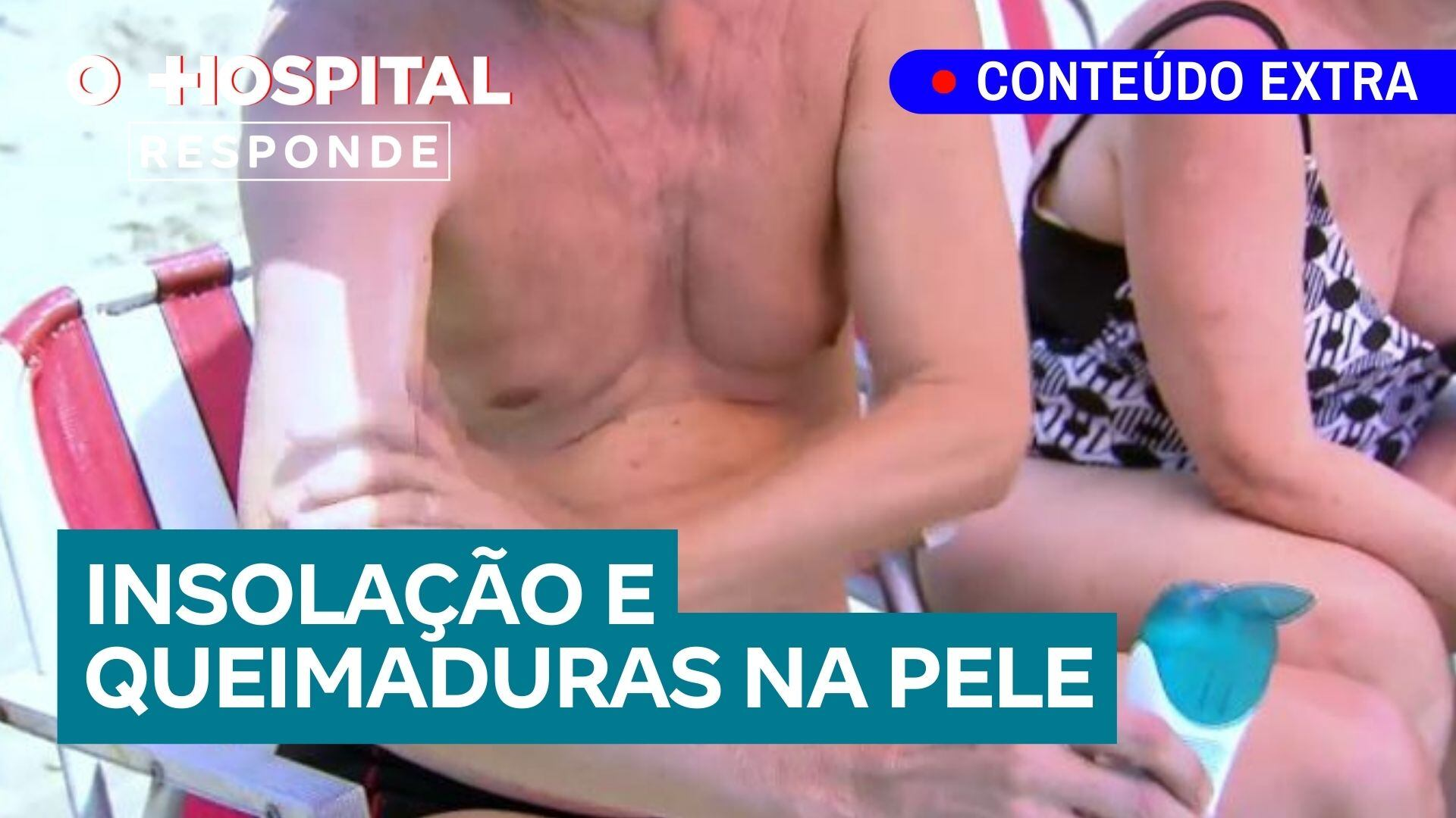 Como se proteger da insolação e das queimaduras de sol | O Hospital Responde