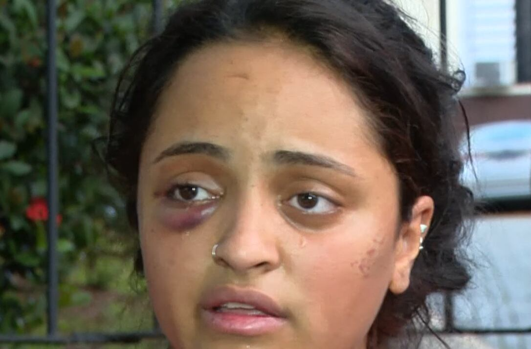 Jovem é agredida por companheiro no Rio; suspeito acaba preso ao tentar fazer visita em hospital