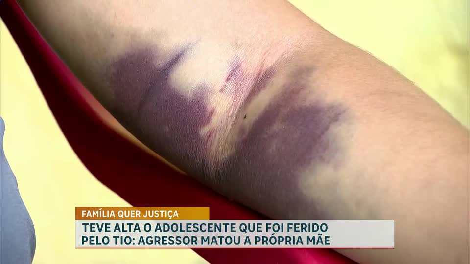 Adolescente que sobreviveu a ataque do tio recebe alta em Belo Horizonte 
