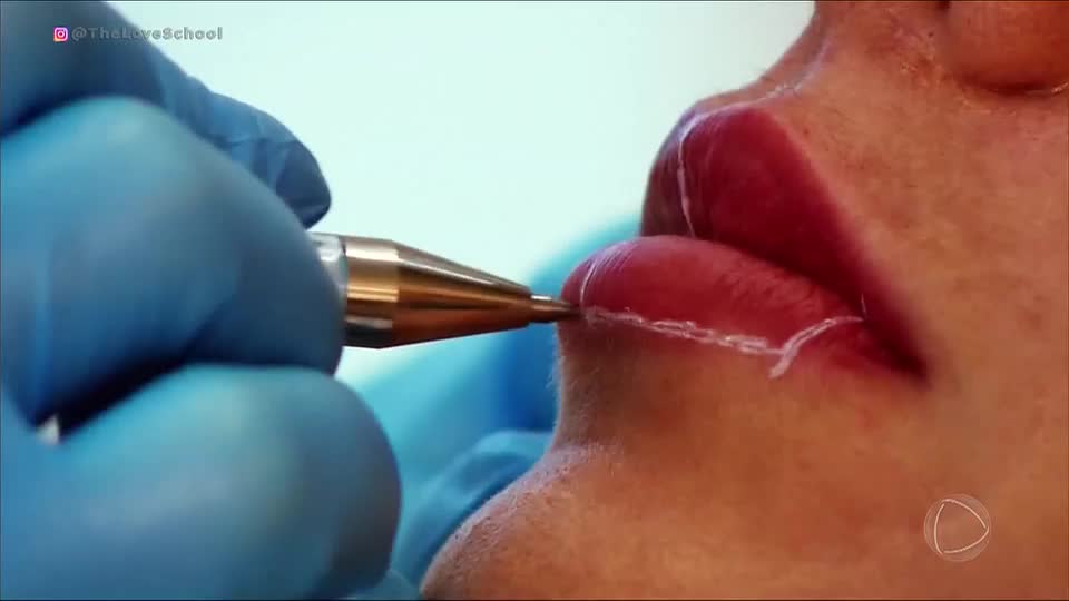 Conheça histórias de pessoas que se submeteram a procedimentos estéticos que deram errado