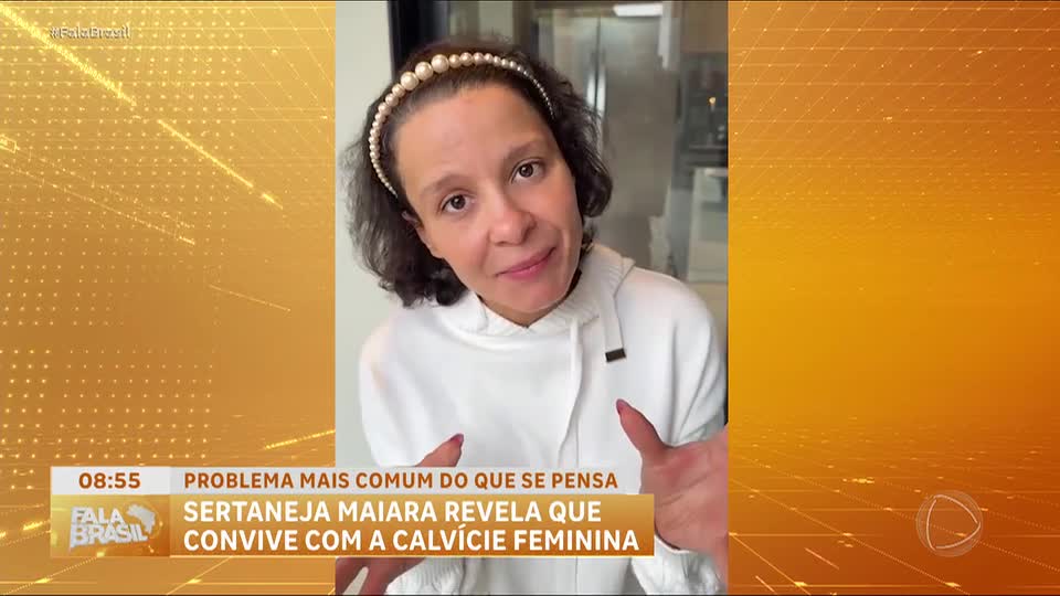 Alopecia androgenética: saiba mais sobre a doença que afeta a cantora Maiara, da dupla com Maraisa 