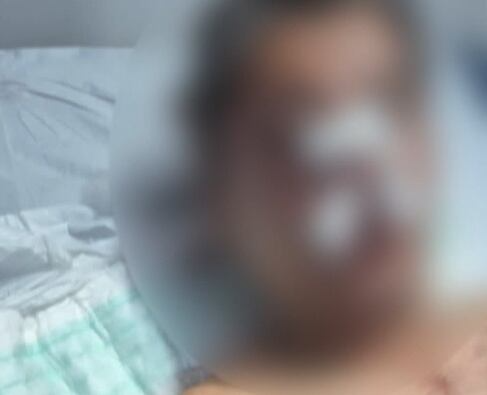 Polícia procura 4 homens que agrediram empresário no RJ