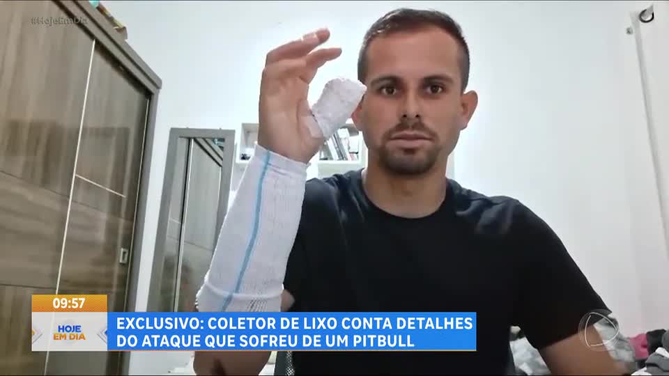 Coletor de lixo conta detalhes do ataque que sofreu de pitbull em São Paulo