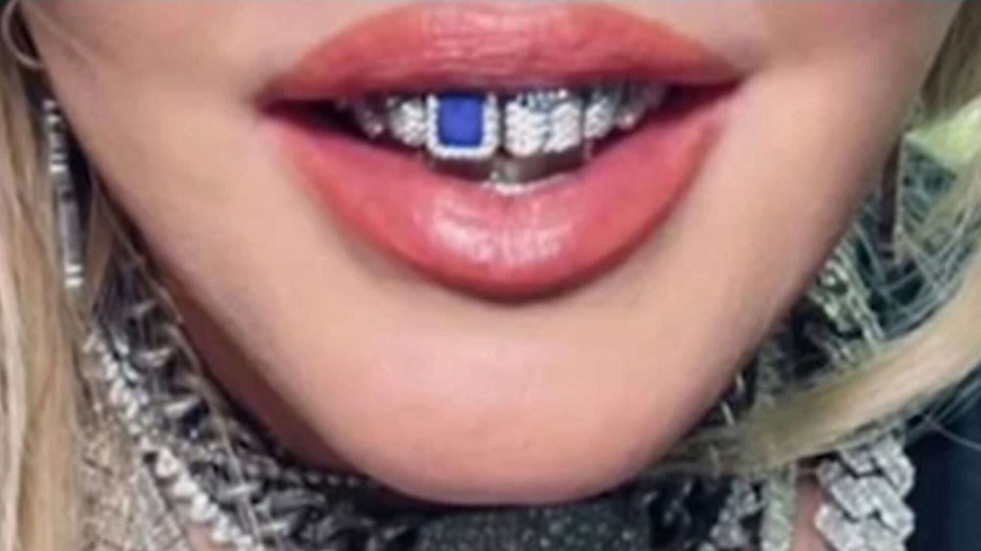 Madonna ostenta joia dental cravejada de diamantes avaliada em R$ 260 mil 