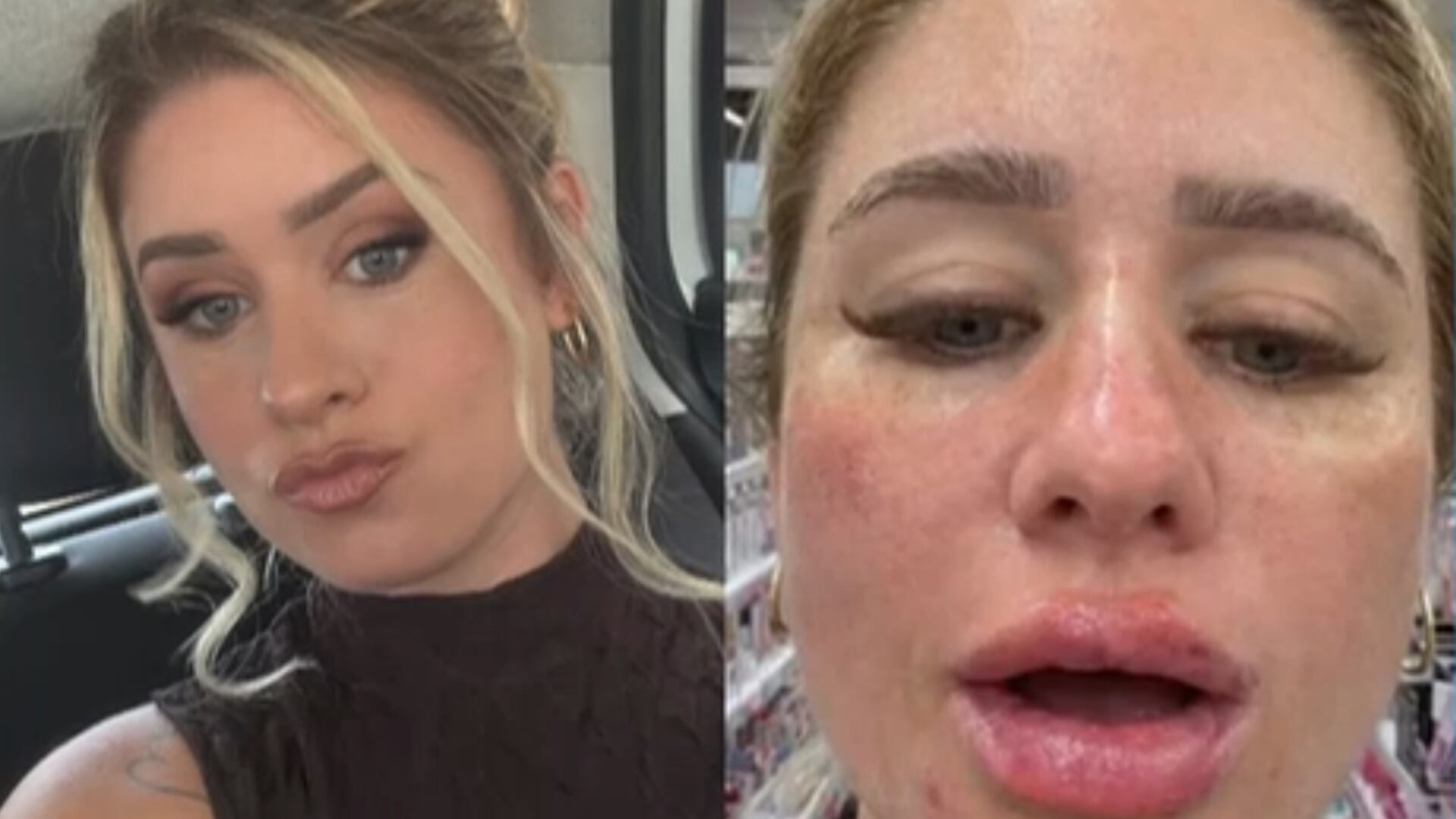 'Influenciadora' não consegue desbloquear o celular após procedimentos estéticos