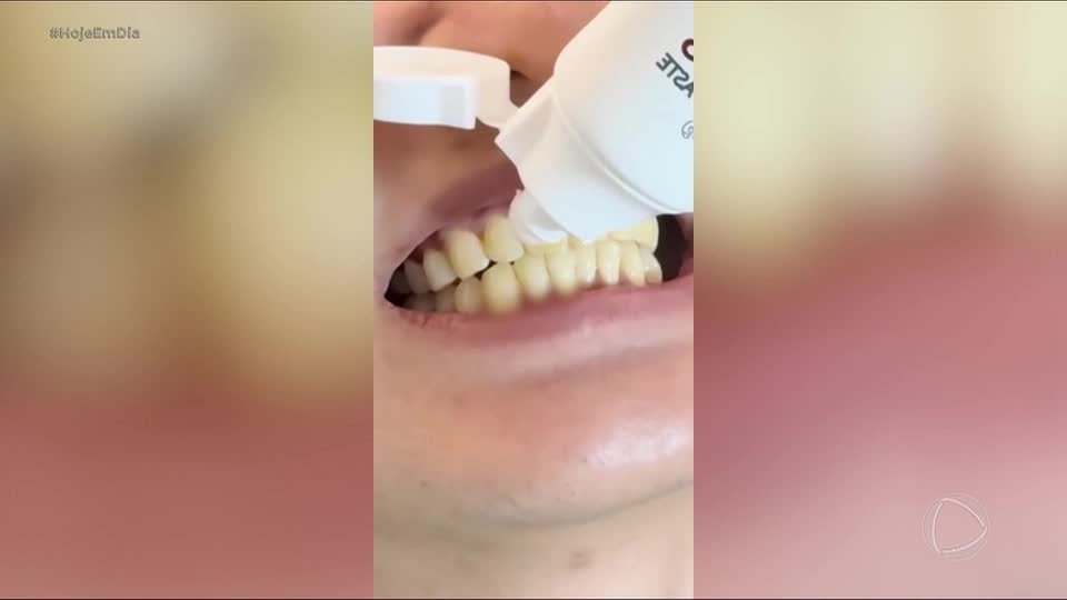 Conheça os riscos de usar fitas clareadoras dentais sem selo da Anvisa ou acompanhamento