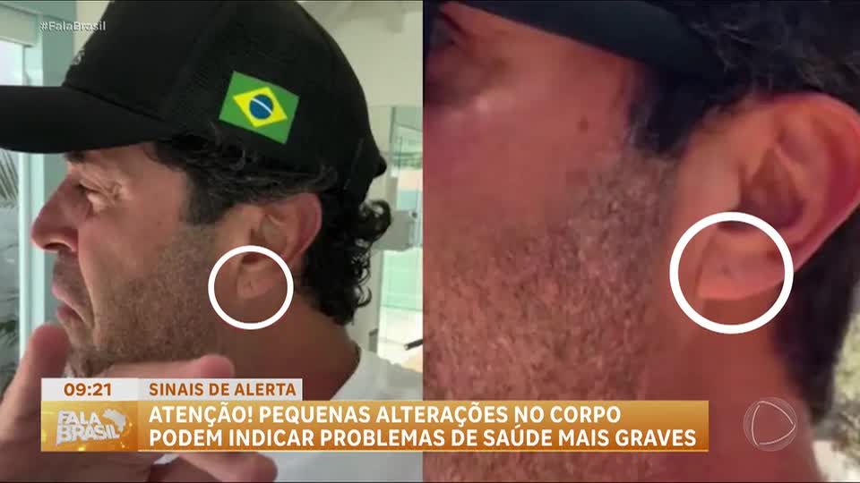 Pequenas alterações no corpo podem indicar problemas de saúde mais graves