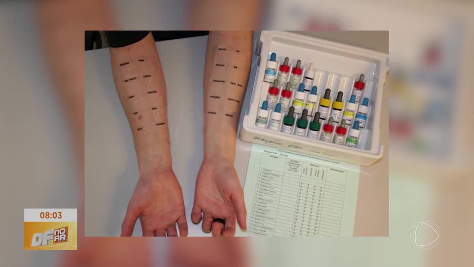 Alergias: entenda como elas podem surgir a qualquer momento da vida