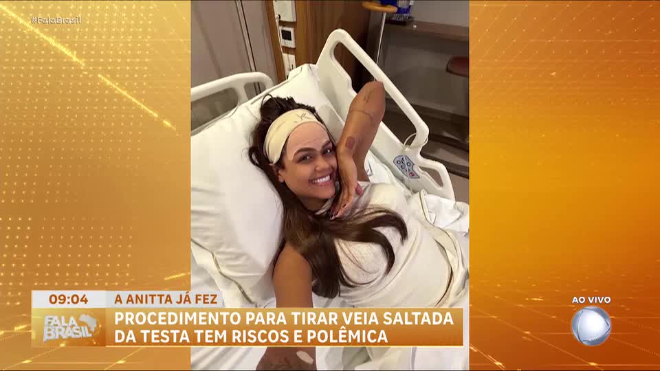 Especialistas alertam para riscos de procedimento estético que remove veia saltada na testa