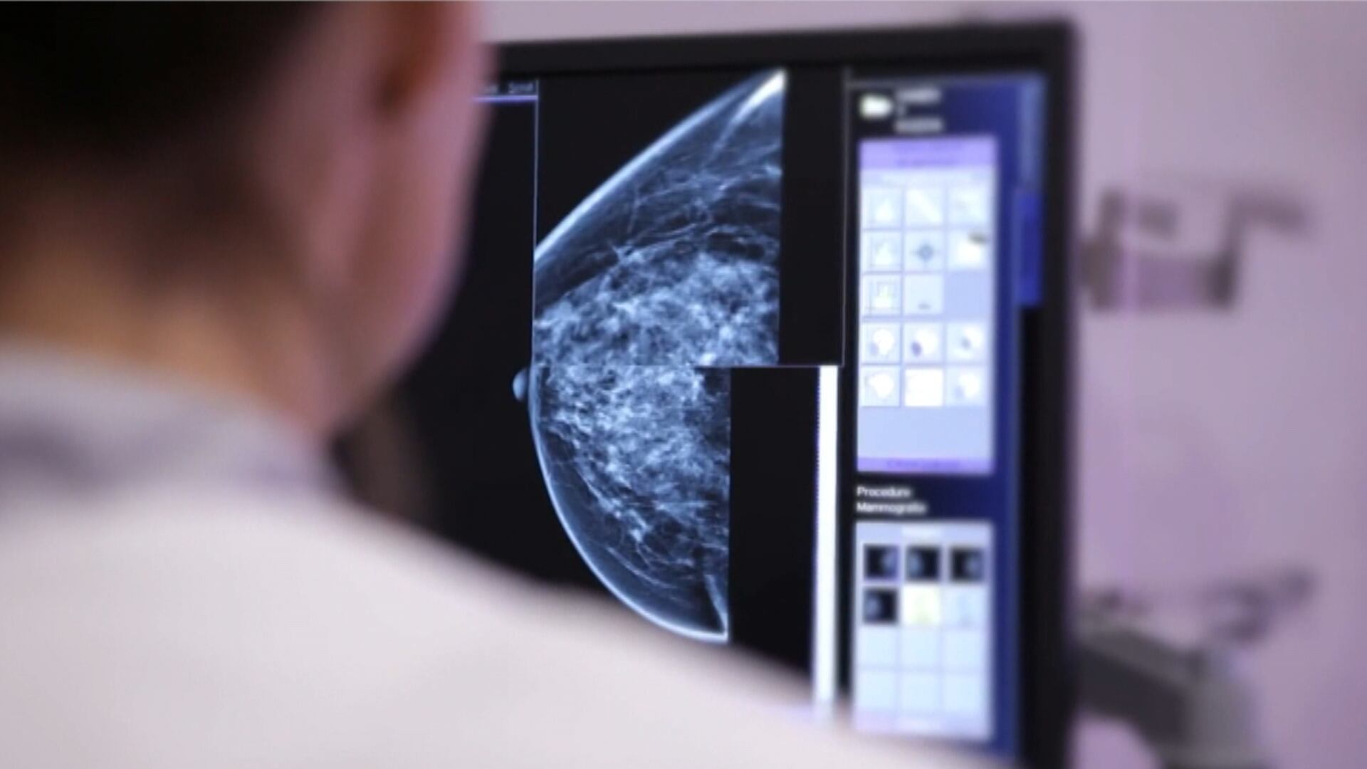 BH expande em 165% a oferta de exames de mamografia