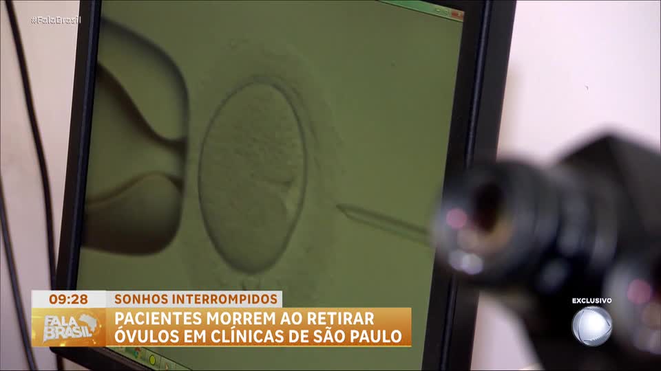 Duas mortes em procedimento de coleta de óvulos no mesmo mês geram investigações em São Paulo