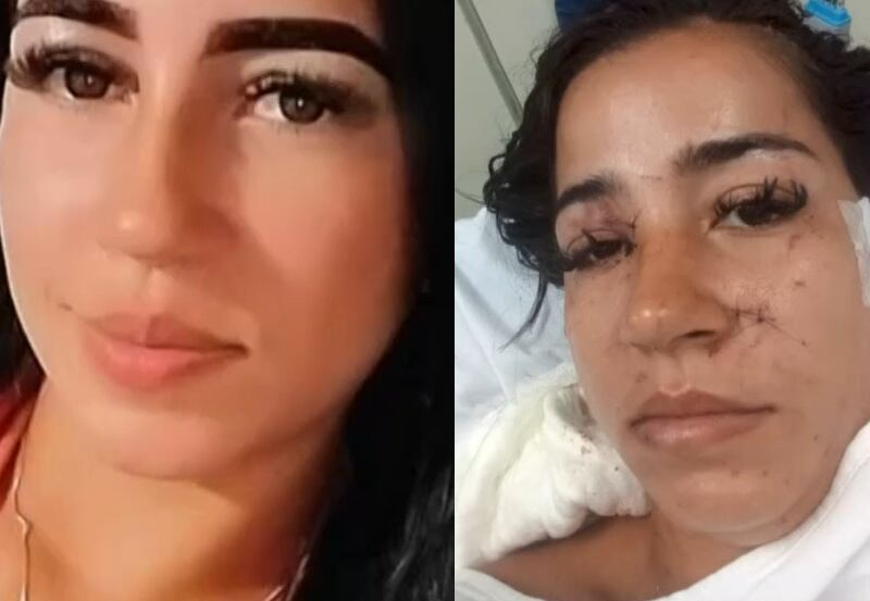 Mulher é atacada com mais de 30 facadas por ex-sogra e ex-amante do marido já falecido no Rio