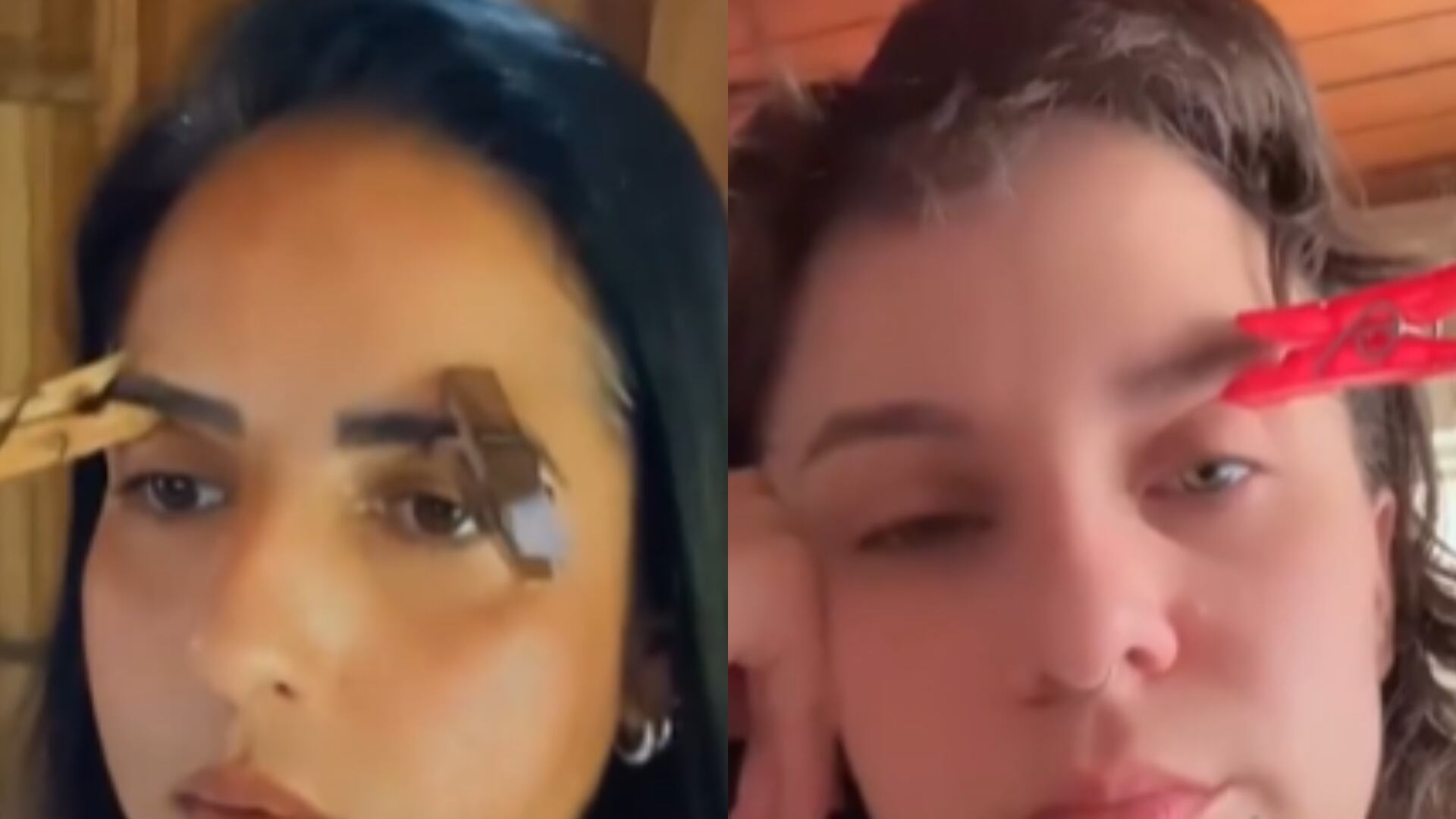 Pregador na sobrancelha alivia enxaqueca? Especialista explica técnica que viralizou