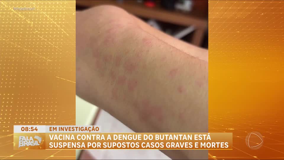 Aplicação da vacina contra a dengue do Butantan é suspensa após reações adversas