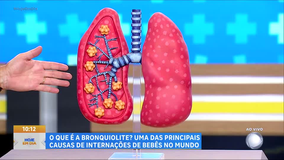 Você e o Doutor: Saiba mais sobre a bronquiolite, uma das principais causas de internações de bebês