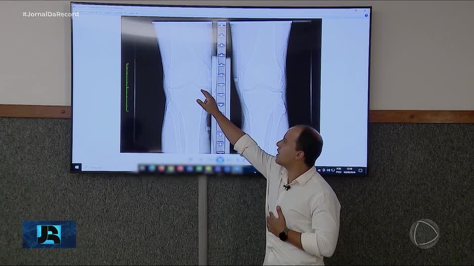 Programa de inteligência artificial desenvolvido em MG ajuda a detectar artrose precocemente