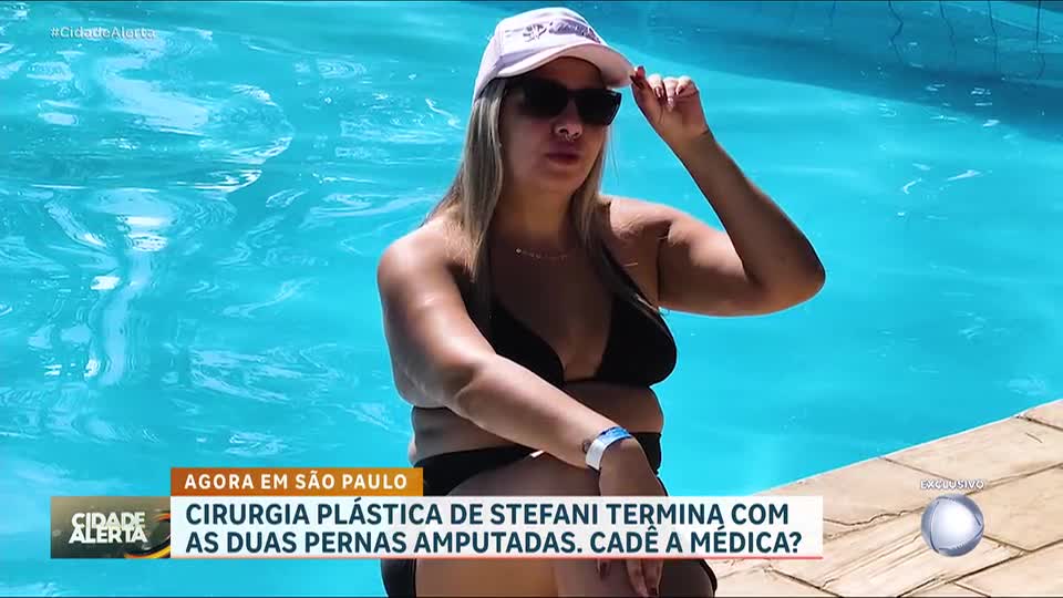 Cirurgia plástica termina com amputação das pernas de mãe de três filhos