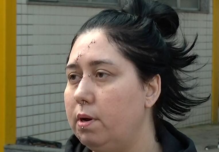 Mulher é agredida por casal ao tentar defender o filho em confusão em bar no Rio