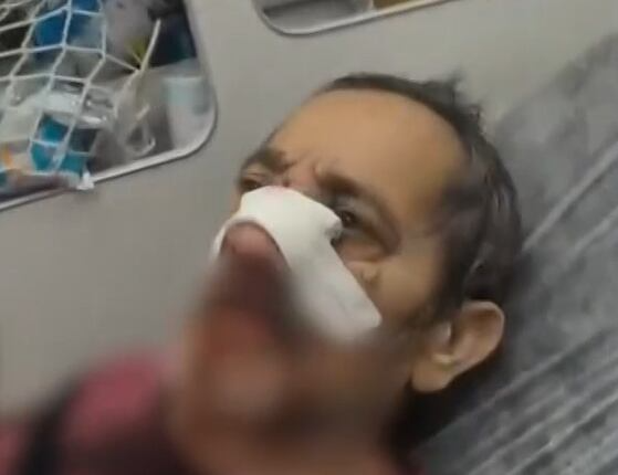 Idoso de 80 anos é agredido por motociclista após discussão no Rio de Janeiro