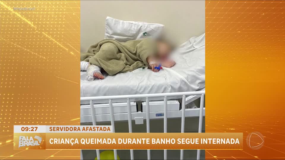 Criança queimada durante banho em creche segue internada em Campo Bom (RS)