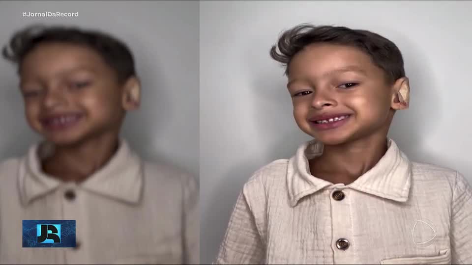 Menino de seis anos que sofria bullying ganha cirurgia para corrigir orelhas