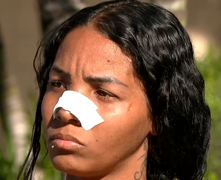 Mulher é agredida pelo ex-marido durante visita ao filho no Rio de Janeiro