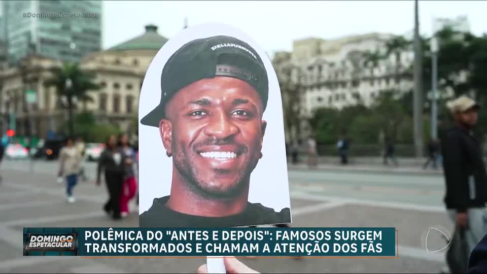 Harmonização facial conquista homens e transforma autoestima de famosos