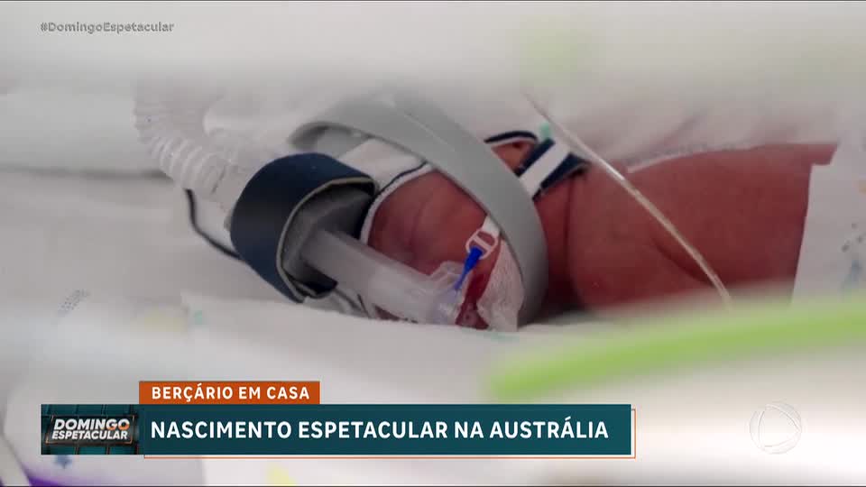 Aconteceu no Mundo: Quadrigêmeos idênticos nascem na Austrália em caso raro