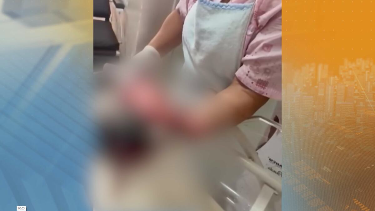Bebê transferida do Acre após queimadura recebe alta no hospital João 23, em BH
