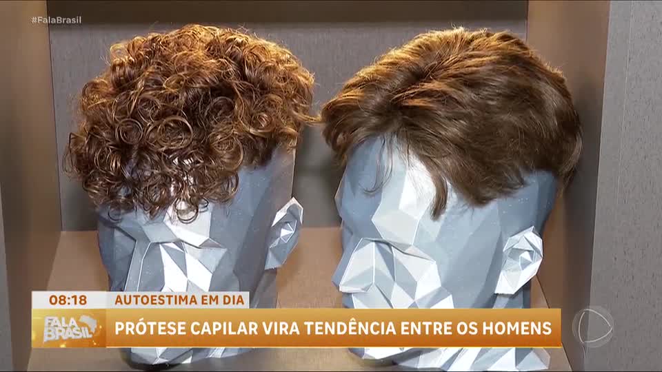 Homens encontram confiança e autoestima ao adotarem próteses capilares