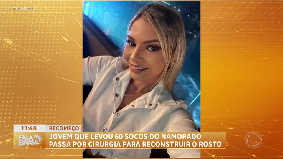 Mulher que levou 60 socos do namorado passa por cirurgia de nove horas para reconstruir rosto