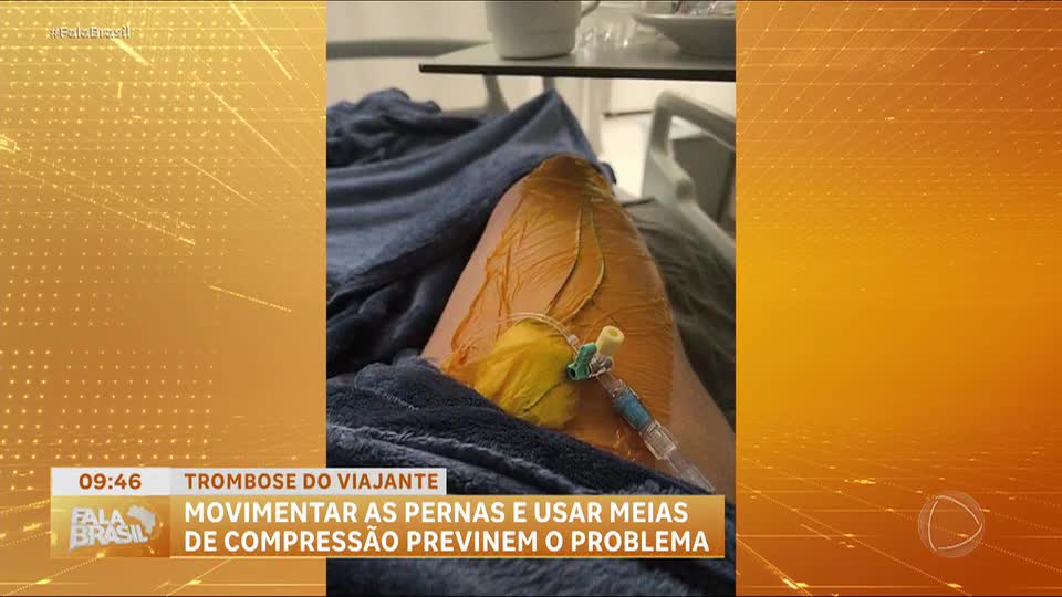 'Trombose do viajante': veja os sintomas da condição e como preveni-la