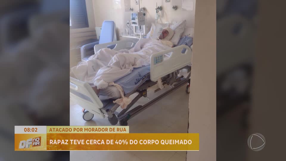 Ataque de morador de rua deixa homem com queimaduras graves; mãe relata drama