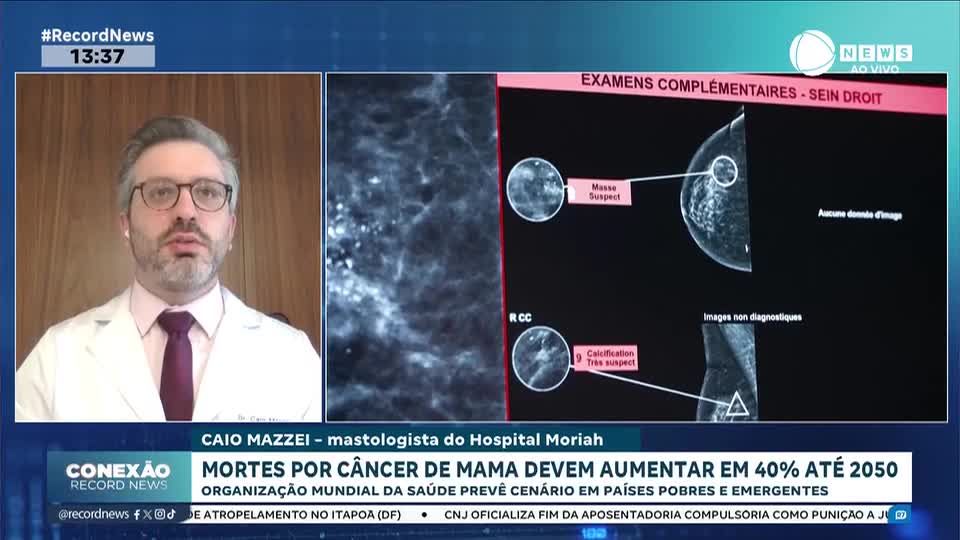 Mortes por câncer de mama devem aumentar em 40% até 2050