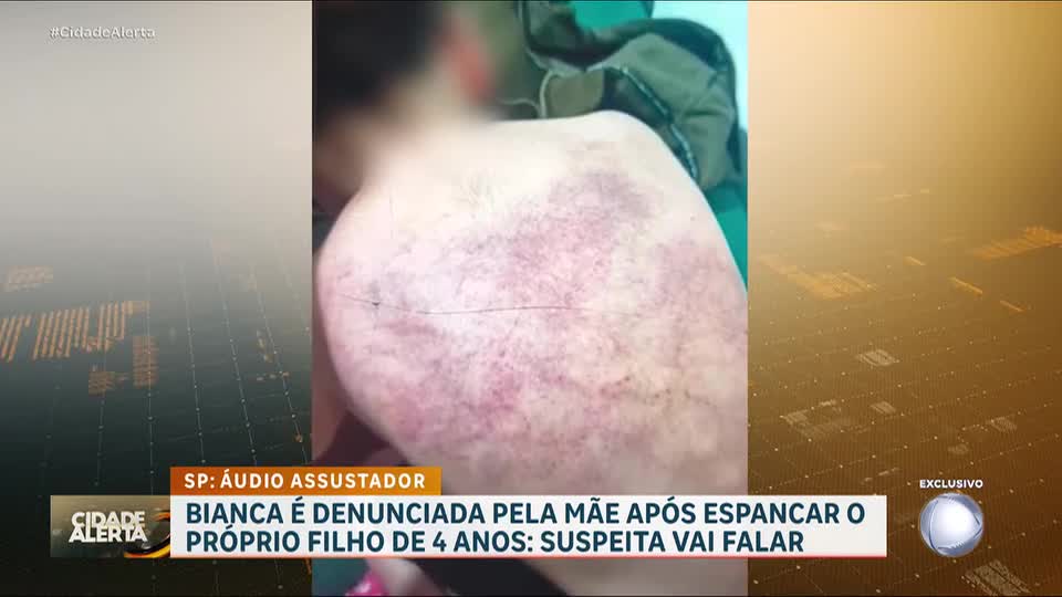 Avó denuncia própria filha após neto de 4 anos ser espancado