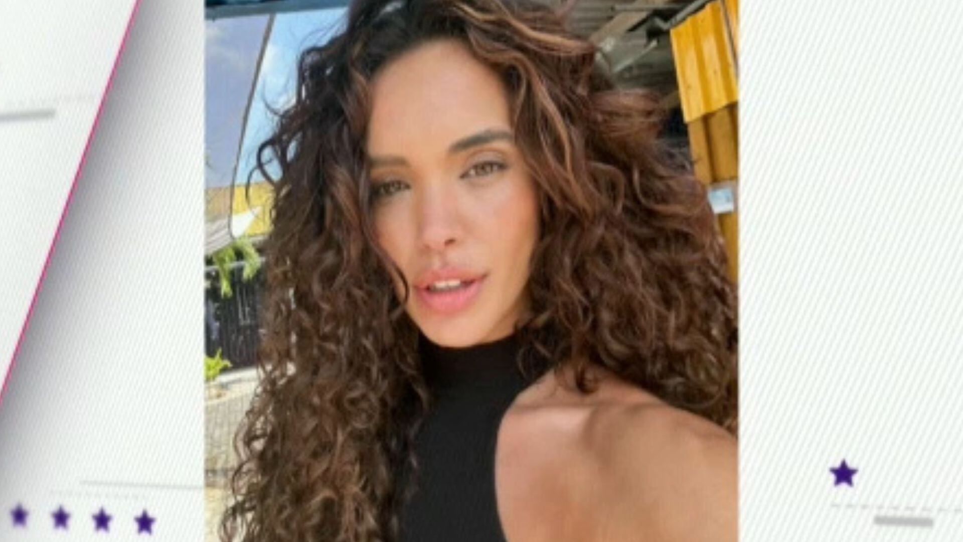 Giovanna Cordeiro perde a sobrancelha e mostra antes e depois de procedimento estético
