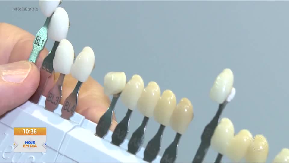 Brancorexia: entenda quando a vontade de ter dentes branquinhos vira uma grave obsessão