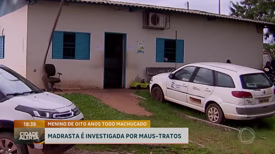 Madrasta é investigada por maus-tratos contra enteado de oito anos em Ceilândia (DF)