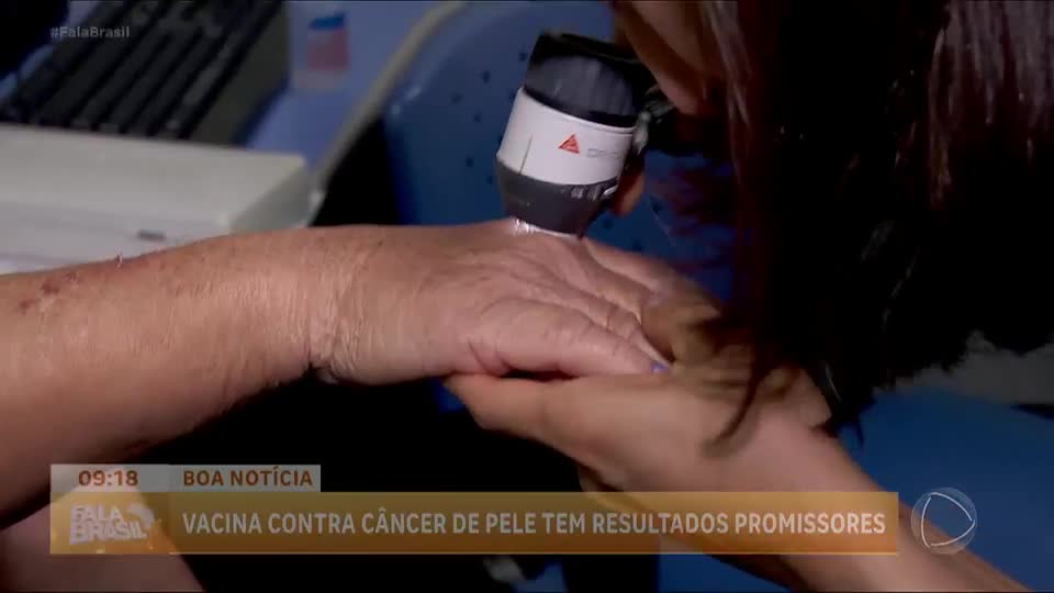 Boa Notícia: Vacina para tratamento de câncer de pele está em fase avançada de testes nos EUA