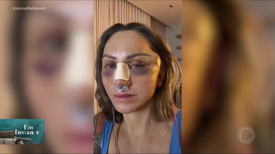 Paciente relata sequelas em procedimentos com médico investigado por morte de empresária em Goiânia